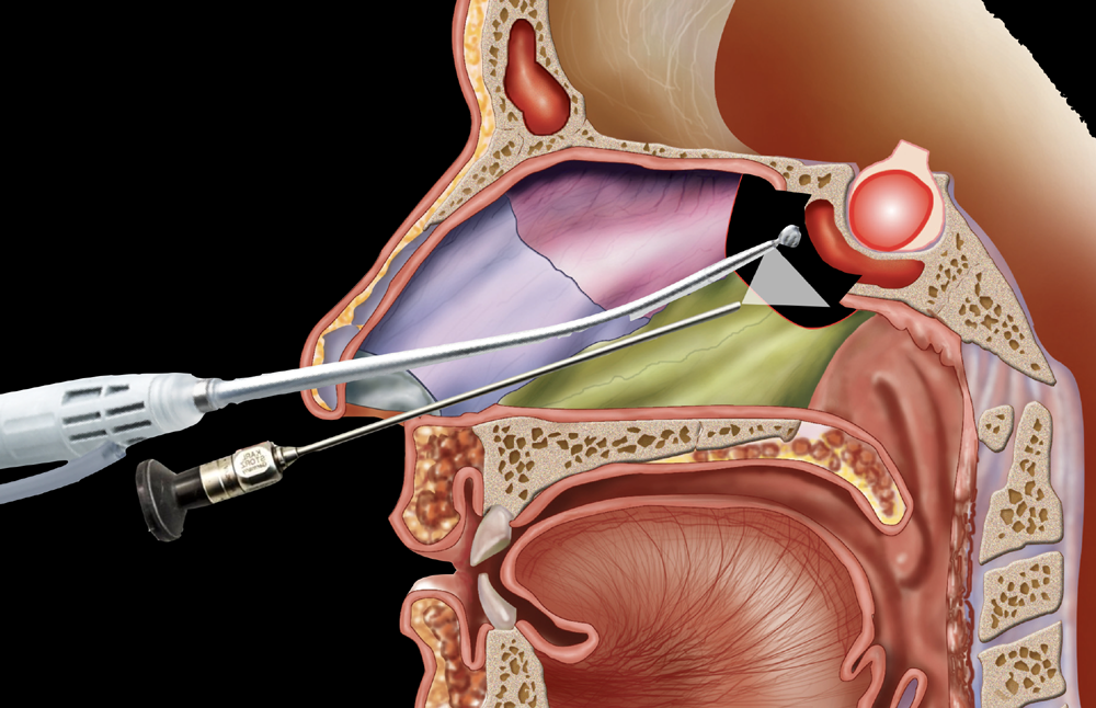 Pituitary Gland