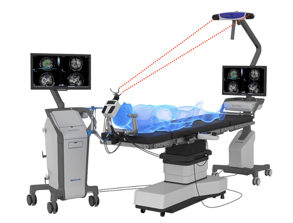 Endoscopic SkullBase Surgery