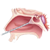 Endoscopic Skull Base Surgery