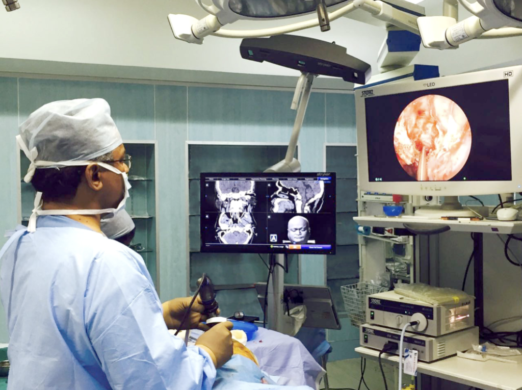 Endoscopic SkullBase Surgery