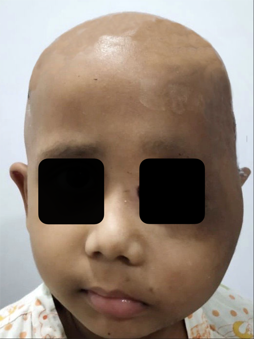 Fig.7b. After surgery and chemotherapy