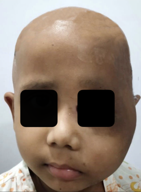 Fig.7b. After surgery and chemotherapy